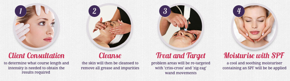 microdermabrasion four step process