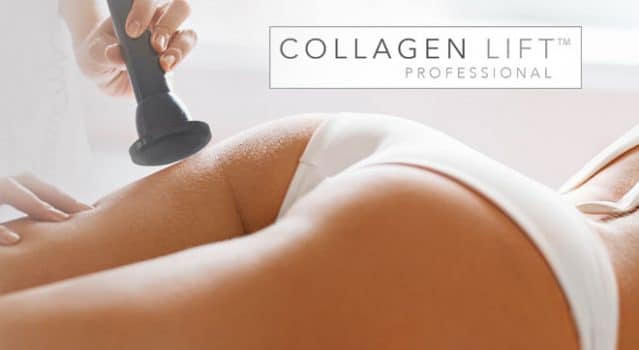 collagen-lift-at-Segais-beauty-salons-didcot-Wantage