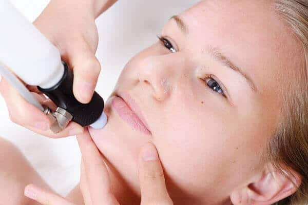 SkinBase Microdermabrasion Wantage Salon